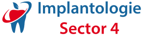 implant dentar