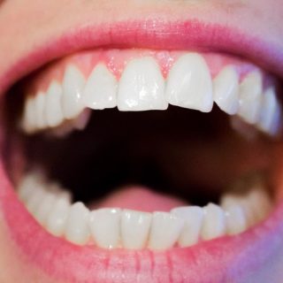 punte dentara