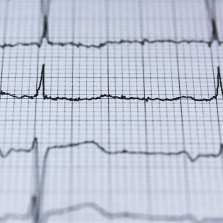 holtere EKG de vanzare