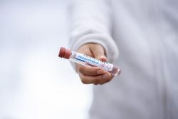 convulsii febrile